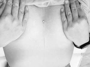 Dermal